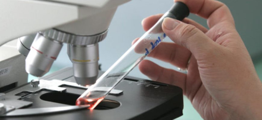 Новости про - Качественное ПЦР исследование на HCV и его расшифровка