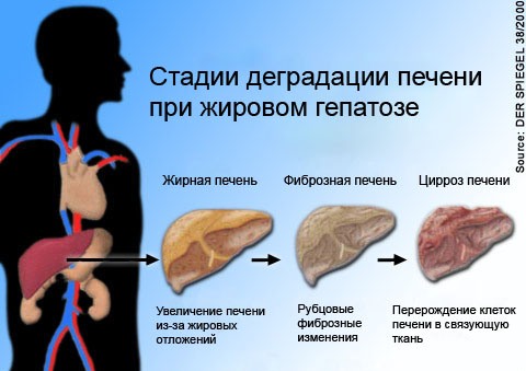Новости про - Симптомы диффузии паренхимы и что с этим делать